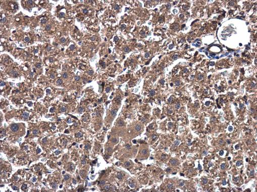 Immunohistochemistry (Formalin/PFA-fixed paraffin-embedded sections) - Anti-Ssu72 antibody (AB229054), expandable thumbnail