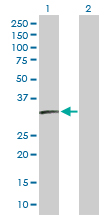 Western blot - Anti-SSX2 antibody (AB172209)