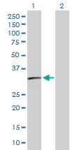 Western blot - Anti-SSX2 antibody (AB172209)