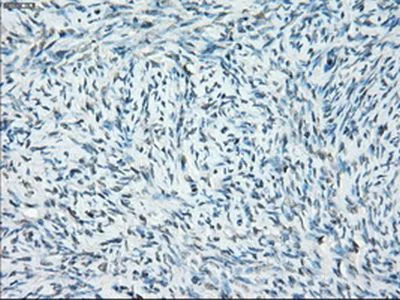 Immunohistochemistry (Formalin/PFA-fixed paraffin-embedded sections) - Anti-SSX2 antibody [OTI4A11] (AB236415)