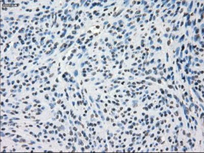 Immunohistochemistry (Formalin/PFA-fixed paraffin-embedded sections) - Anti-SSX2 antibody [OTI4A11] (AB236415)