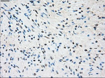 Immunohistochemistry (Formalin/PFA-fixed paraffin-embedded sections) - Anti-SSX2 antibody [OTI4A11] (AB236415)