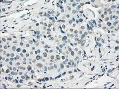 Immunohistochemistry (Formalin/PFA-fixed paraffin-embedded sections) - Anti-SSX2 antibody [OTI4A11] (AB236415)