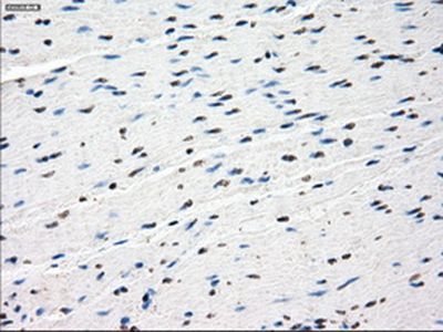 Immunohistochemistry (Formalin/PFA-fixed paraffin-embedded sections) - Anti-SSX2 antibody [OTI4A11] (AB236415)