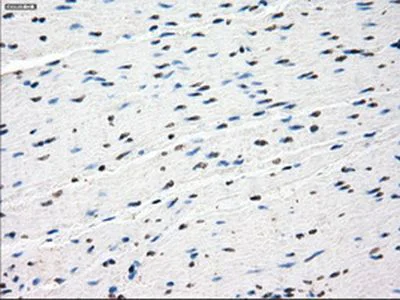 Immunohistochemistry (Formalin/PFA-fixed paraffin-embedded sections) - Anti-SSX2 antibody [OTI4A11] (AB236415)