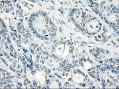 Immunohistochemistry (Formalin/PFA-fixed paraffin-embedded sections) - Anti-SSX2 antibody [OTI4A11] (AB236415)