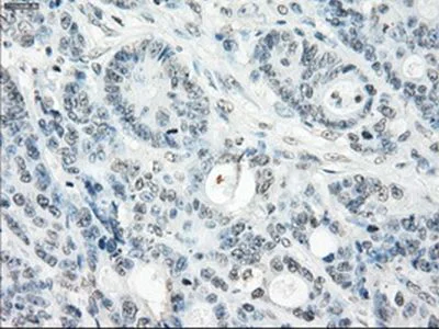 Immunohistochemistry (Formalin/PFA-fixed paraffin-embedded sections) - Anti-SSX2 antibody [OTI4A11] (AB236415)