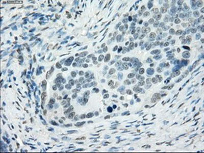 Immunohistochemistry (Formalin/PFA-fixed paraffin-embedded sections) - Anti-SSX2 antibody [OTI4A11] (AB236415)