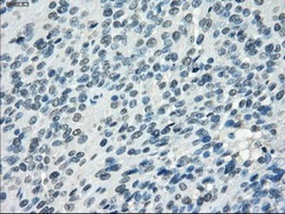 Immunohistochemistry (Formalin/PFA-fixed paraffin-embedded sections) - Anti-SSX2 antibody [OTI4A11] (AB236415)
