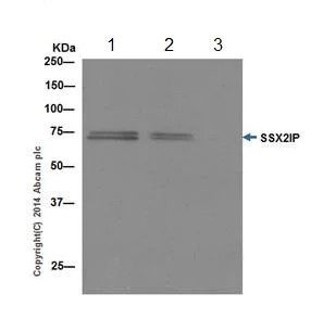 Immunoprecipitation - Anti-SSX2IP antibody [EPR16979] (AB199425)