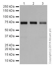 Western blot - Anti-SSX2IP antibody [EPR16979] (AB199425)