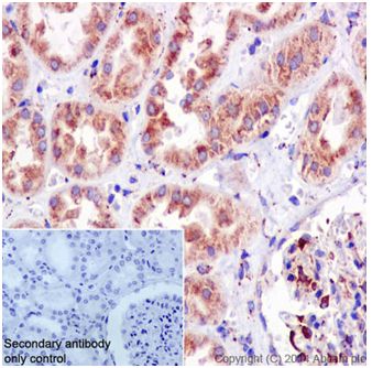 Immunohistochemistry (Formalin/PFA-fixed paraffin-embedded sections) - Anti-SSX2IP antibody [EPR16979] - BSA and Azide free (AB240348), expandable thumbnail