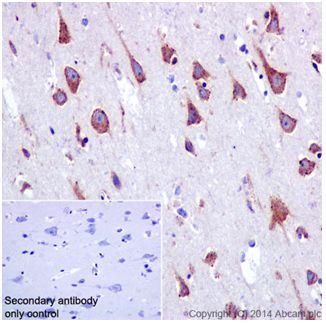 Immunohistochemistry (Formalin/PFA-fixed paraffin-embedded sections) - Anti-SSX2IP antibody [EPR16979] - BSA and Azide free (AB240348), expandable thumbnail