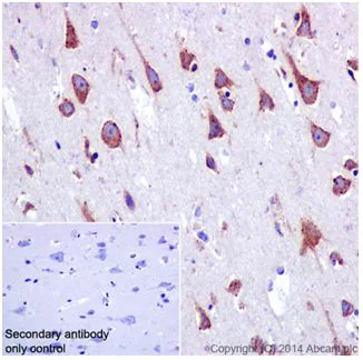 Immunohistochemistry (Formalin/PFA-fixed paraffin-embedded sections) - Anti-SSX2IP antibody [EPR16979] - BSA and Azide free (AB240348)
