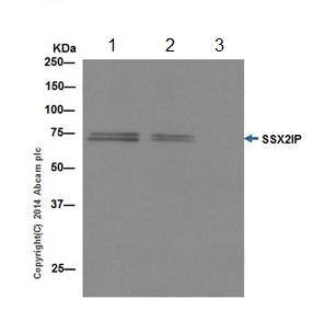 Immunoprecipitation - Anti-SSX2IP antibody [EPR16979] - BSA and Azide free (AB240348), expandable thumbnail