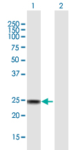 Western blot - Anti-SSX4 antibody (AB172215), expandable thumbnail