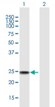 Western blot - Anti-SSX4 antibody (AB172215)