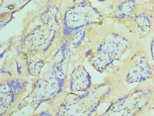 Immunohistochemistry (Formalin/PFA-fixed paraffin-embedded sections) - Anti-ST14 antibody (AB235925)