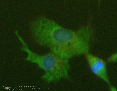 Immunocytochemistry/ Immunofluorescence - Anti-ST14 antibody - Catalytic domain (AB28266)