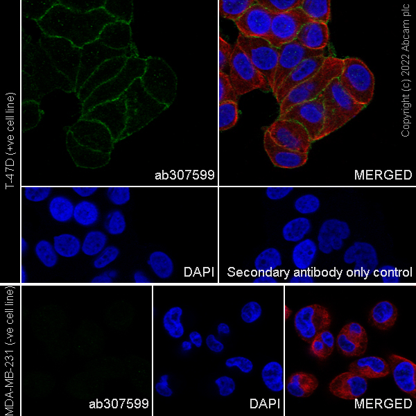Immunocytochemistry/ Immunofluorescence - Anti-ST14 antibody [EPR26785-94] - BSA and Azide free (ab307600), expandable thumbnail