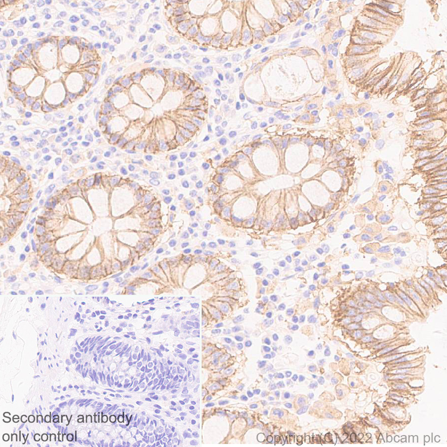 Immunohistochemistry (Formalin/PFA-fixed paraffin-embedded sections) - Anti-ST14 antibody [EPR26785-94] - BSA and Azide free (ab307600), expandable thumbnail