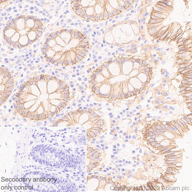 Immunohistochemistry (Formalin/PFA-fixed paraffin-embedded sections) - Anti-ST14 antibody [EPR26785-94] - BSA and Azide free (AB307600)