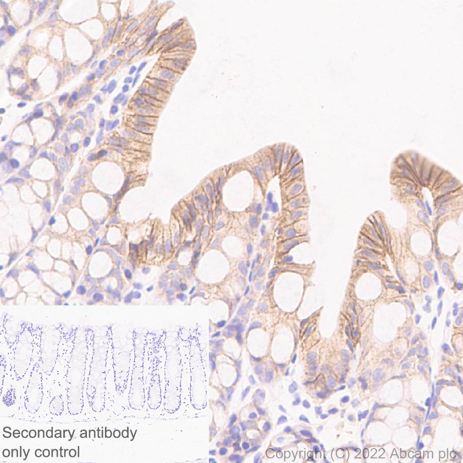 Immunohistochemistry (Formalin/PFA-fixed paraffin-embedded sections) - Anti-ST14 antibody [EPR26785-94] - BSA and Azide free (ab307600), expandable thumbnail