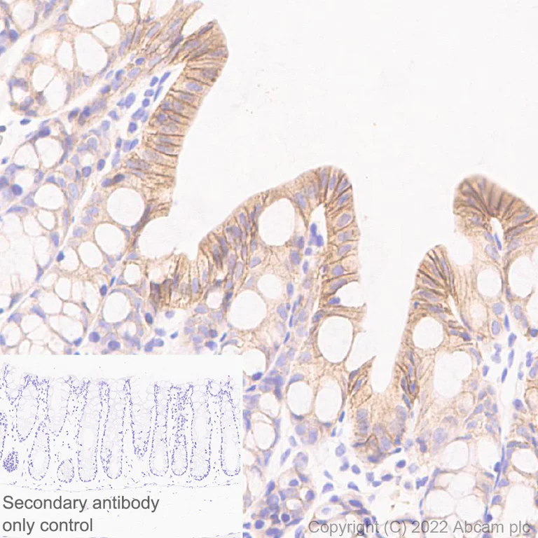 Immunohistochemistry (Formalin/PFA-fixed paraffin-embedded sections) - Anti-ST14 antibody [EPR26785-94] - BSA and Azide free (AB307600)