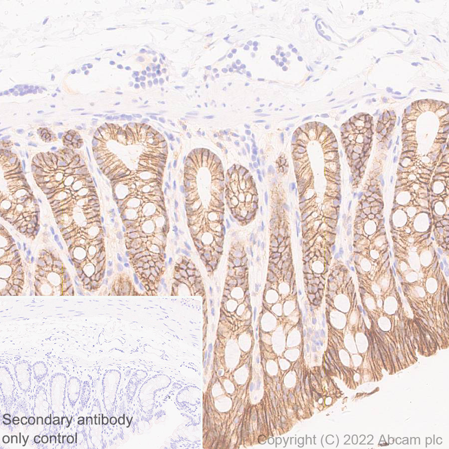 Immunohistochemistry (Formalin/PFA-fixed paraffin-embedded sections) - Anti-ST14 antibody [EPR26785-94] - BSA and Azide free (AB307600), expandable thumbnail