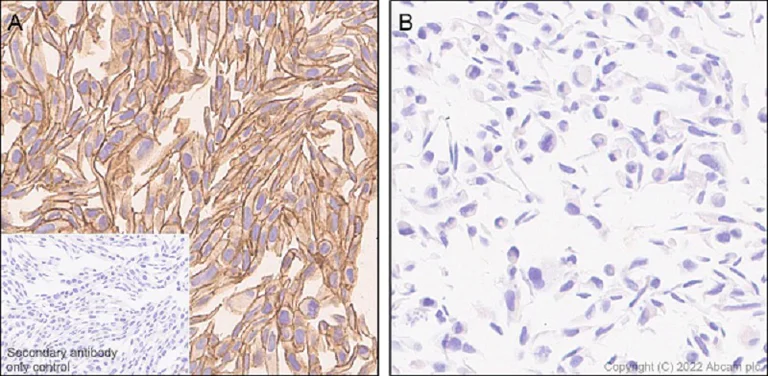 Immunohistochemistry (Formalin/PFA-fixed paraffin-embedded sections) - Anti-ST14 antibody [EPR26785-94] - BSA and Azide free (AB307600)