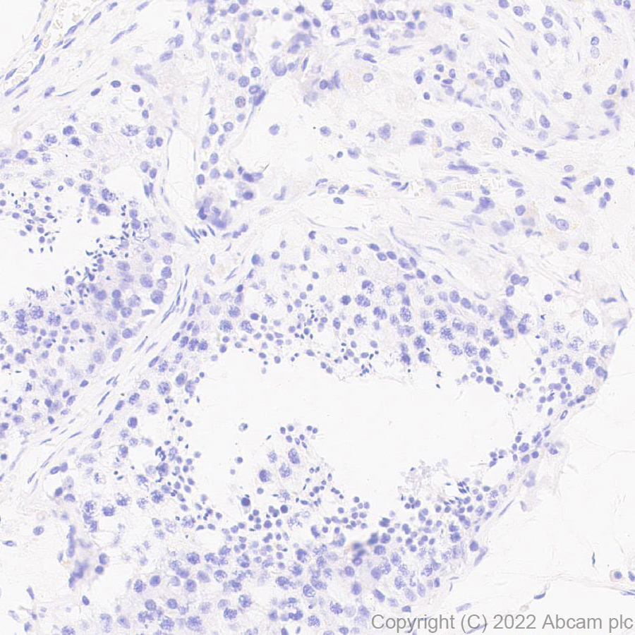 Immunohistochemistry (Formalin/PFA-fixed paraffin-embedded sections) - Anti-ST14 antibody [EPR26785-94] - BSA and Azide free (AB307600), expandable thumbnail