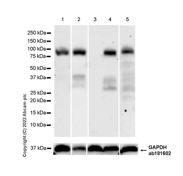 Western blot - Anti-ST14 antibody [EPR26785-94] - BSA and Azide free (AB307600)