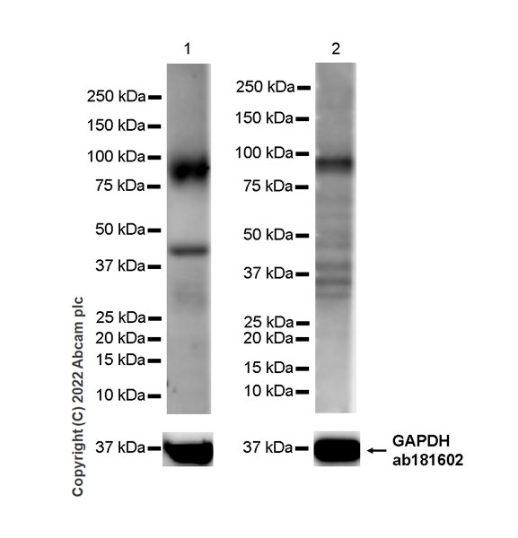 Western blot - Anti-ST14 antibody [EPR26785-94] - BSA and Azide free (AB307600), expandable thumbnail