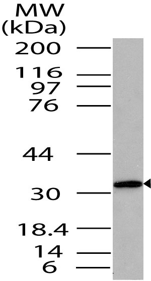 Western blot - Anti-ST2 antibody (AB208283)