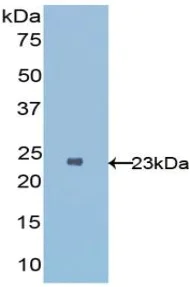 Western blot - Anti-ST2 antibody (AB233433)