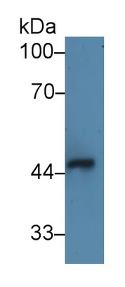 Western blot - Anti-ST2 antibody (AB233433)