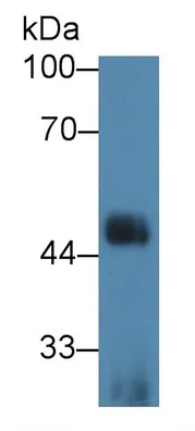 Western blot - Anti-ST2 antibody (AB233433)