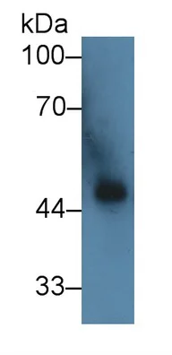 Western blot - Anti-ST2 antibody (AB233433)