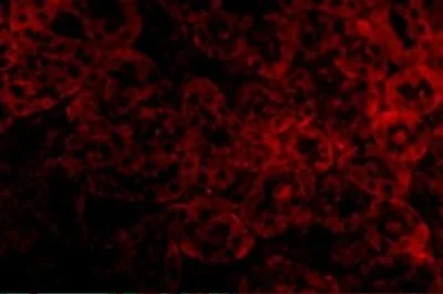 Immunocytochemistry/ Immunofluorescence - Anti-ST2 antibody - BSA free (AB25877)