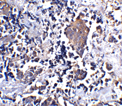 Immunohistochemistry (Formalin/PFA-fixed paraffin-embedded sections) - Anti-ST2 antibody - BSA free (AB25877)