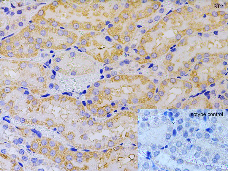 Immunohistochemistry (Formalin/PFA-fixed paraffin-embedded sections) - Anti-ST2 antibody - BSA free (AB25877)