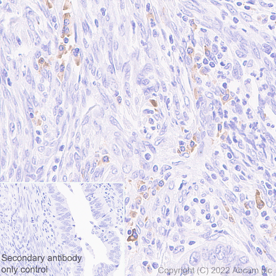 Immunohistochemistry (Formalin/PFA-fixed paraffin-embedded sections) - Anti-ST2 antibody [EPR25264-147] (AB291071), expandable thumbnail