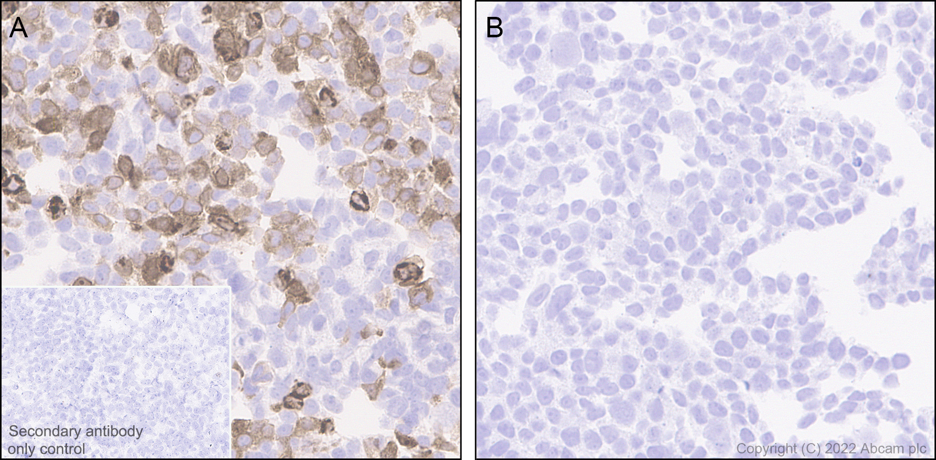Immunohistochemistry (Formalin/PFA-fixed paraffin-embedded sections) - Anti-ST2 antibody [EPR25264-147] (AB291071), expandable thumbnail