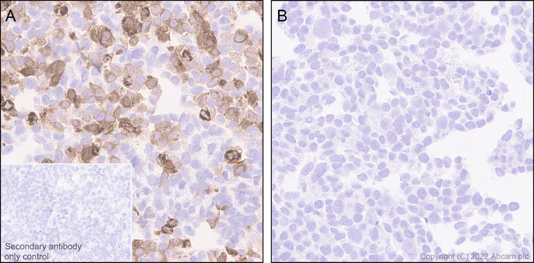 Immunohistochemistry (Formalin/PFA-fixed paraffin-embedded sections) - Anti-ST2 antibody [EPR25264-147] (AB291071)