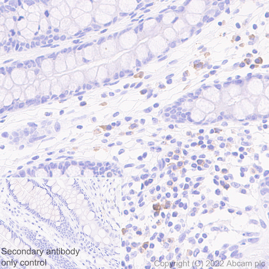 Immunohistochemistry (Formalin/PFA-fixed paraffin-embedded sections) - Anti-ST2 antibody [EPR25264-147] (BSA and Azide free) (AB291094)