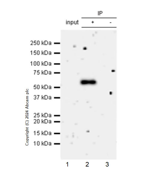 Immunoprecipitation - Anti-ST2 antibody [EPR28307-82] (AB317557), expandable thumbnail