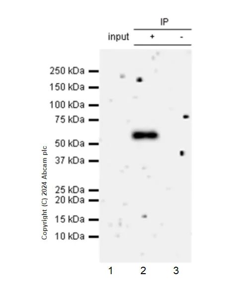 Immunoprecipitation - Anti-ST2 antibody [EPR28307-82] (AB317557)