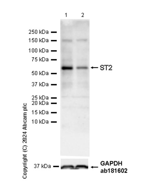 Western blot - Anti-ST2 antibody [EPR28307-82] (AB317557), expandable thumbnail