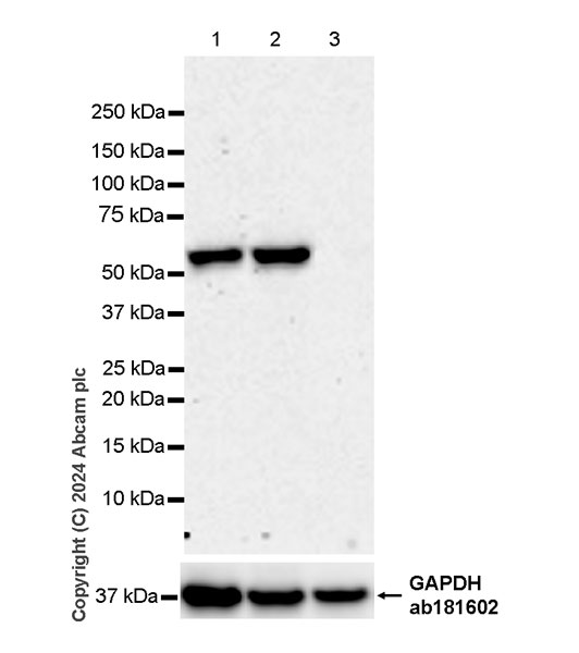 Western blot - Anti-ST2 antibody [EPR28307-82] (AB317557), expandable thumbnail