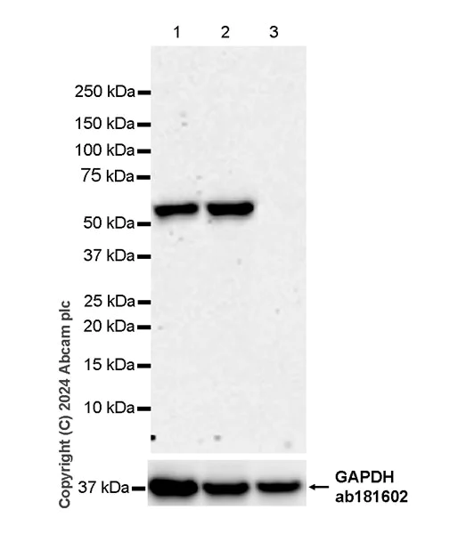 Western blot - Anti-ST2 antibody [EPR28307-82] (AB317557)